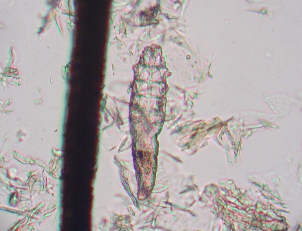demodex mite 1
